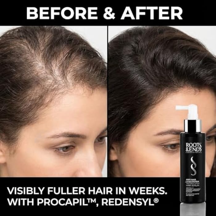 Roots & Ends Anti-Hair Loss Spray - Advanced Hair Spray Growth with Aminexil, Redensyl & Biotin to Improve Hair Density, 120 ML - Image 5